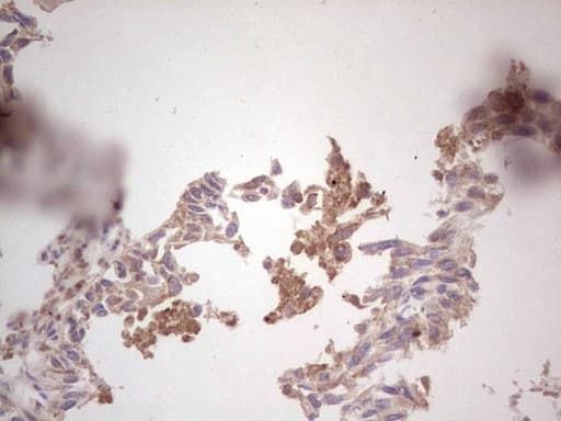 ROS1 / ROS Antibody (aa2126-2347, clone OTI1F3)