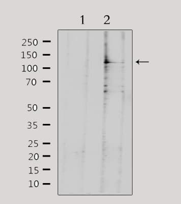 Polyclonal Rabbit anti-Human SDCCAG1 / NEMF Antibody (IF, WB)