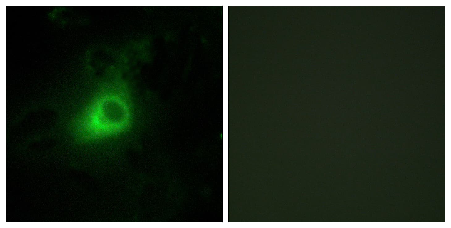 GRK6 Antibody (aa10-59)