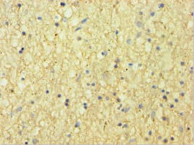 Polyclonal Rabbit anti-Human CNDP1 Antibody (aa1-280, IHC, WB)