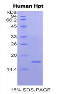 Human HP / Haptoglobin Protein (Recombinant His, N-Terminal)