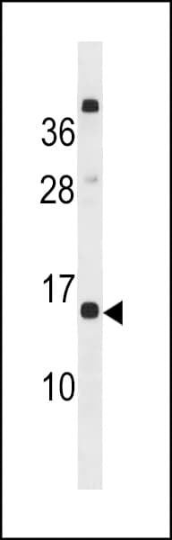 Polyclonal Rabbit anti-Human CLEC19A Antibody (aa54-80, WB)