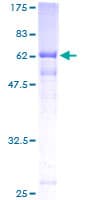 Human IREB2 / IRP2 Protein (Recombinant GST)