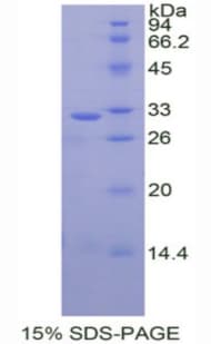 Human NRG1 / Heregulin / Neuregulin Protein (Recombinant His)