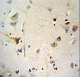 Polyclonal Rabbit anti-Human AGBL5 Antibody (aa99-127, IHC, IF, WB)