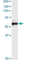 Monoclonal Mouse anti-Human MMP13 Antibody (clone 3B11, WB)