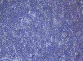 Monoclonal Mouse anti-Human DDX59 Antibody (clone OTI2G1, IHC, WB)
