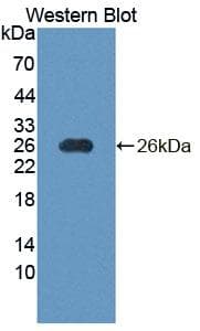 NT5M Antibody (PE)