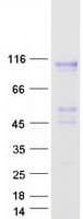 Human CPXM1 / CPXM Protein (Recombinant Myc-DDK (Flag))