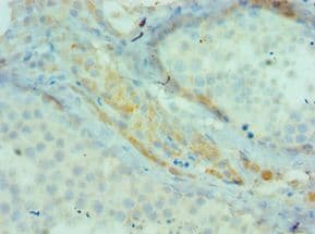 BIRC2 / cIAP1 Antibody (aa1-300)