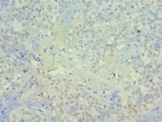 Polyclonal Rabbit anti-Human PIAS1 Antibody (aa422-651, IHC)