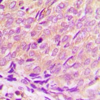 HDAC3 Antibody (C-Terminus)
