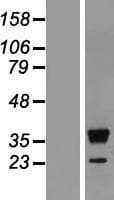 RRP15 Protein (Over-Expression Lysate Myc-DDK (Flag))