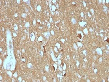 NCAM / CD56 Antibody (clone SPM128)