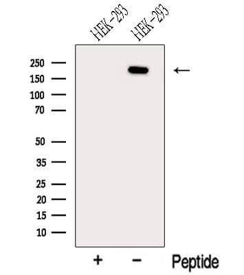 Polyclonal Rabbit anti-Human NCOA6 / ASC-2 Antibody (WB)