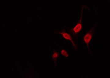 Polyclonal Rabbit anti-Human NEUROD2 Antibody (IF, WB)