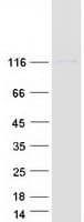 Human OSBPL6 Protein (Recombinant Myc-DDK (Flag))