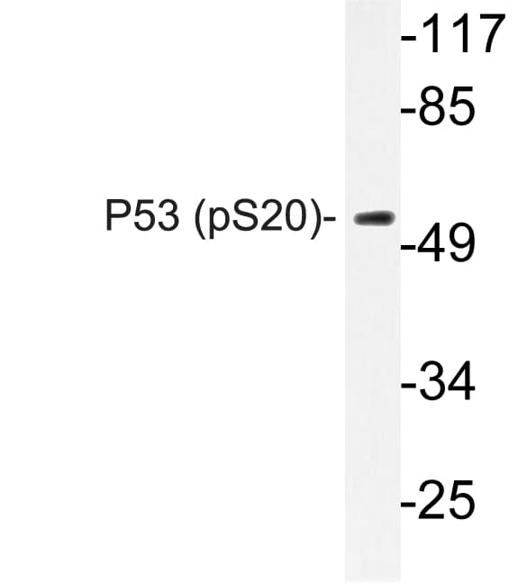 TP53 / p53 Antibody (phospho-Ser20)