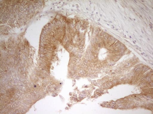 Monoclonal Mouse anti-Human PAK4 Antibody (clone OTI1C7, aa1-308, IHC, WB)