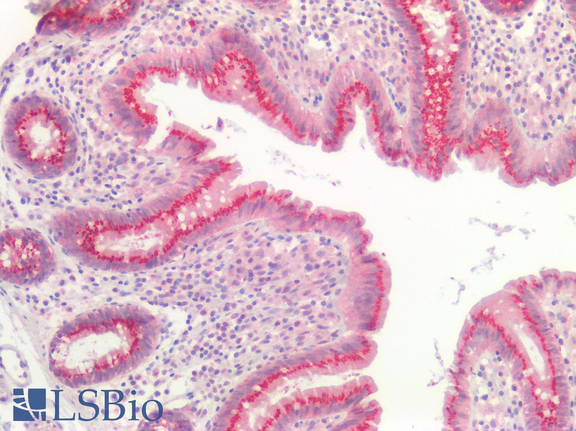 PathPlus™ NOX1 Antibody