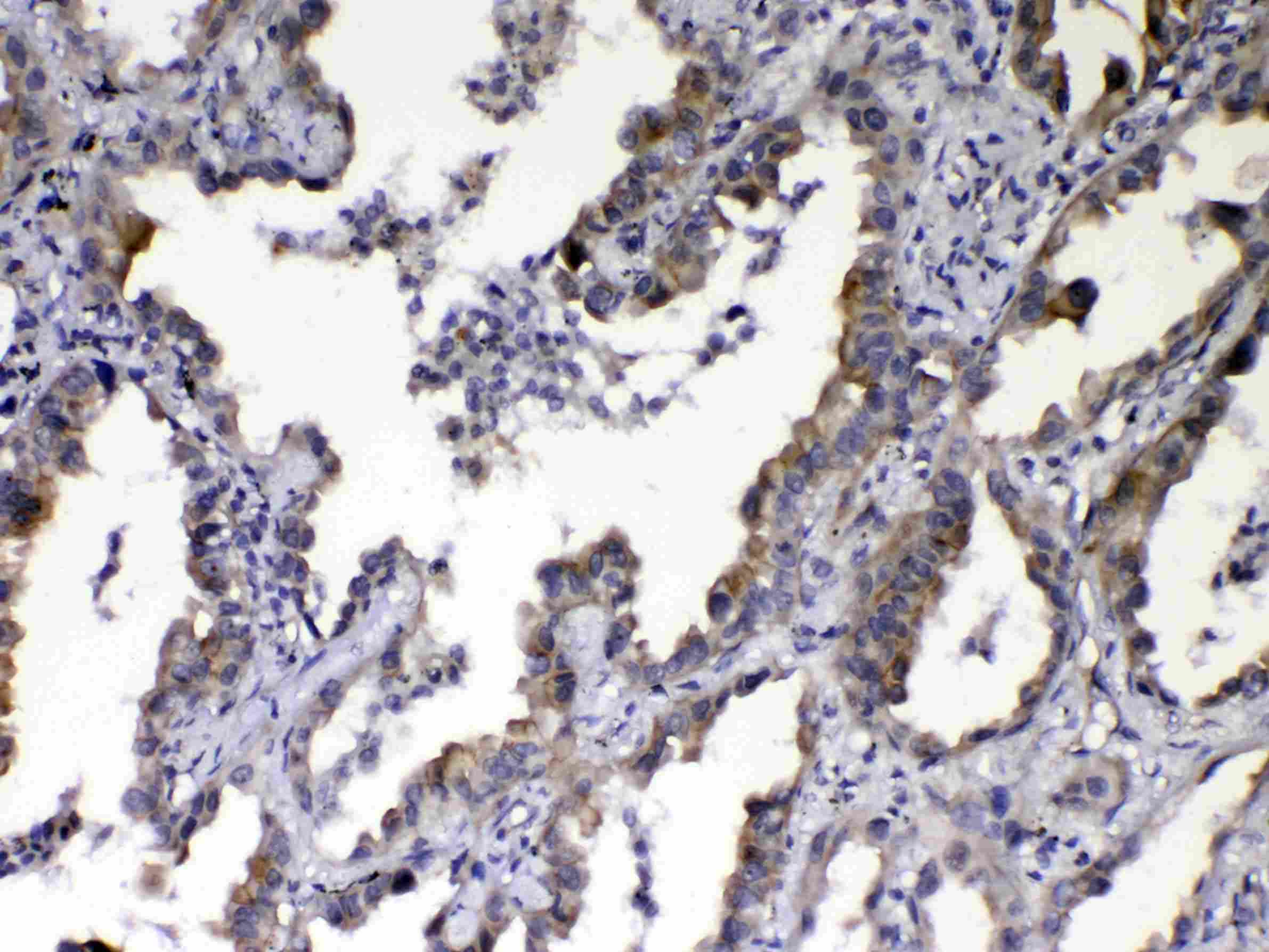 CCN3 / NOV Antibody