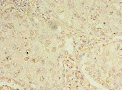 ORMDL1 Antibody