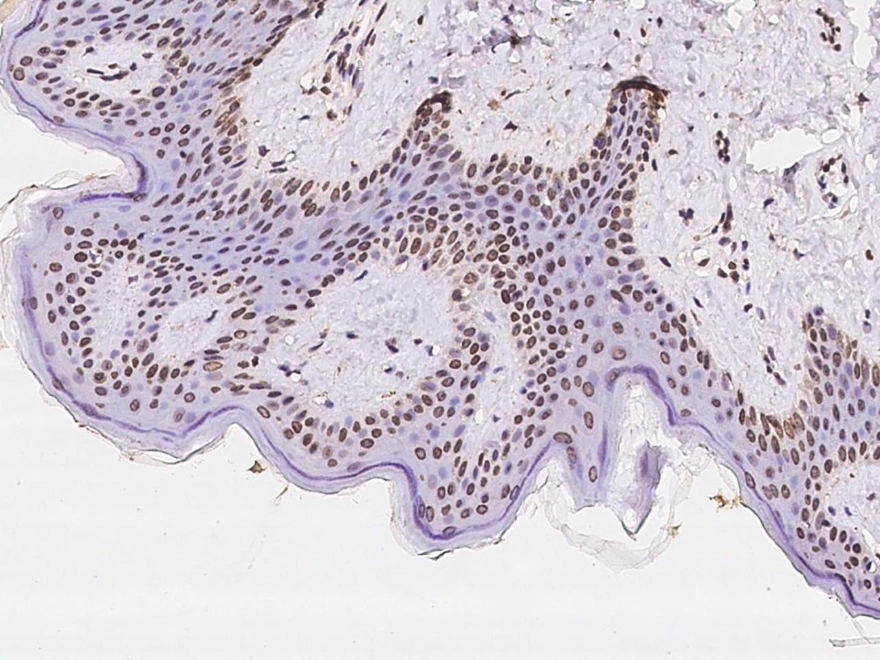 Polyclonal Rabbit anti-Human NLE1 Antibody (IHC, WB)
