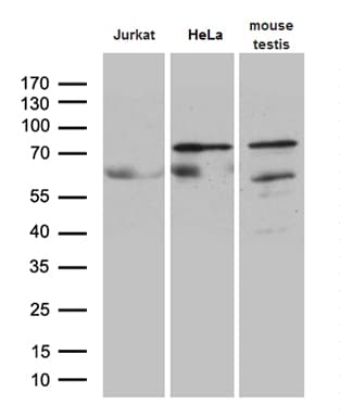 ELL / MEN Antibody (aa302-621, clone OTI3A8)