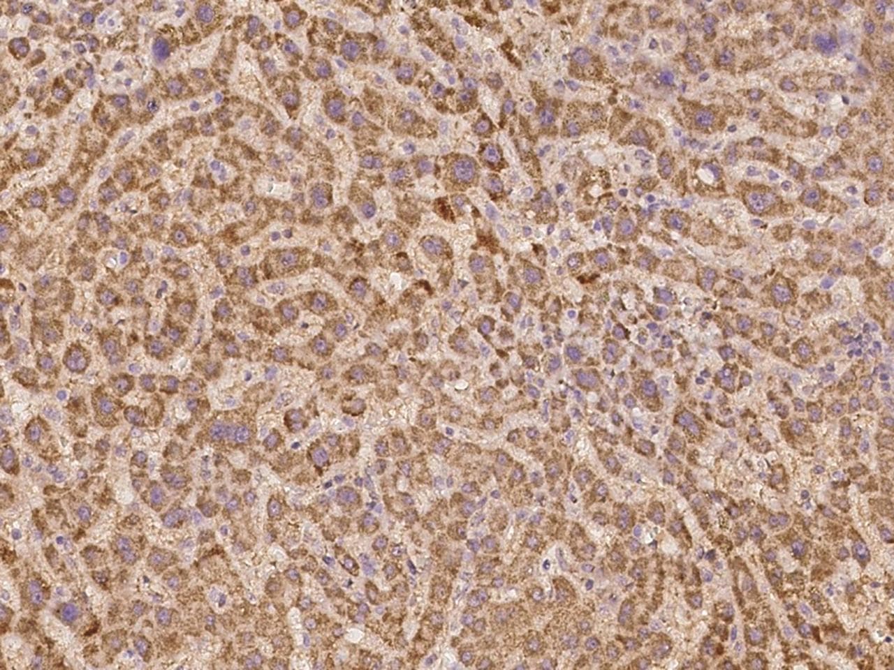 Polyclonal Rabbit anti-Human ZNF280B Antibody (IHC)