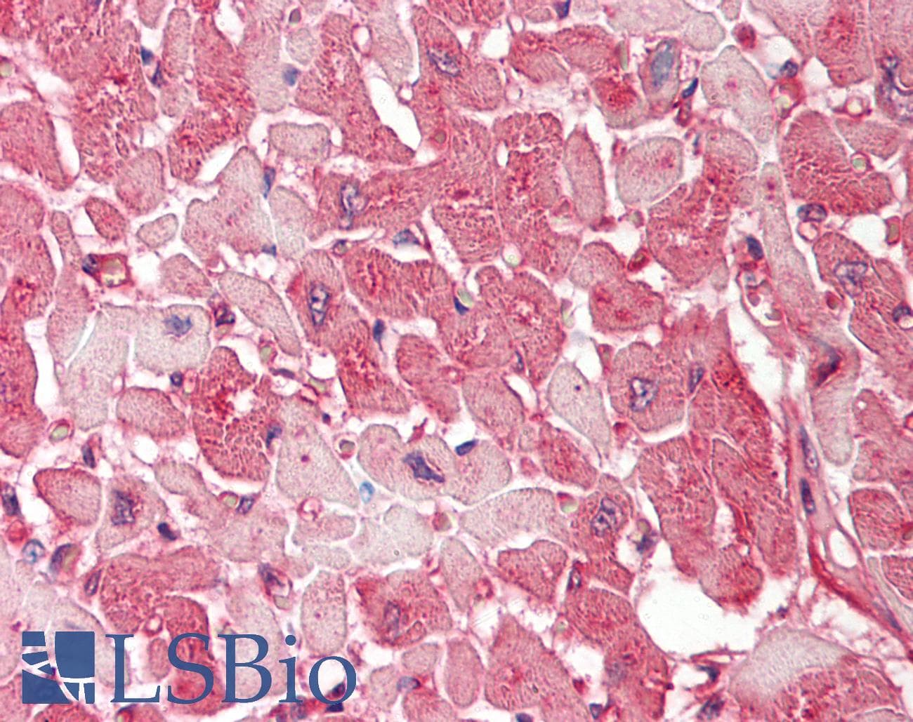 Polyclonal Rabbit anti-Human CLTB Antibody (C-Terminus, IHC, WB)