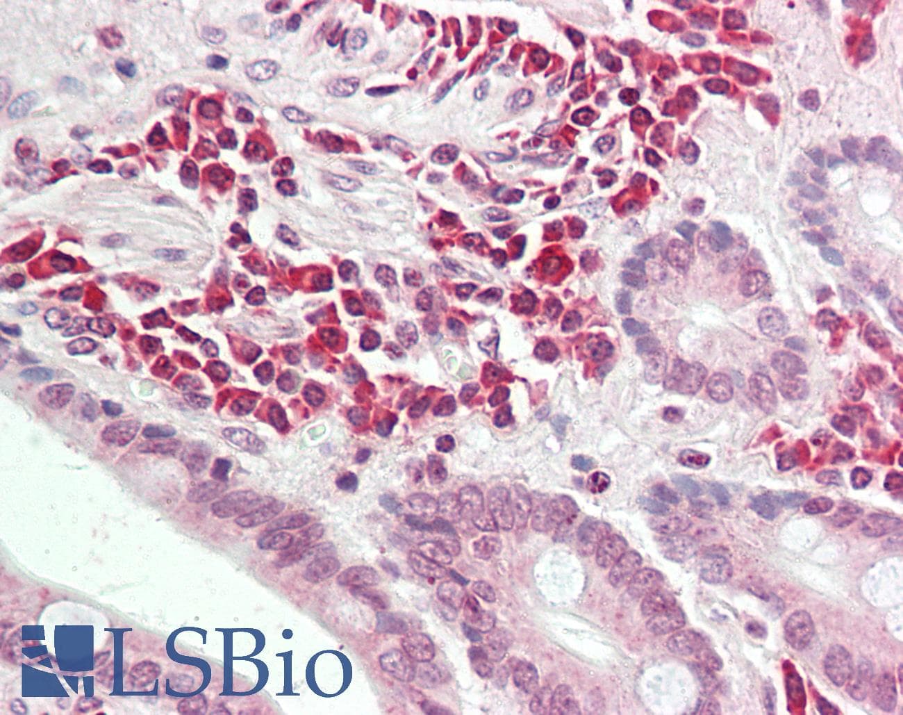 IHC-plus™ ALK3 / BMPR1A Antibody (aa170-197)