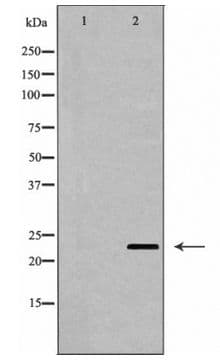 Polyclonal Rabbit anti-Human CD69 Antibody (WB)