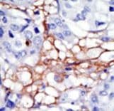 PIP4K2A / PIPK Antibody (aa107-139)