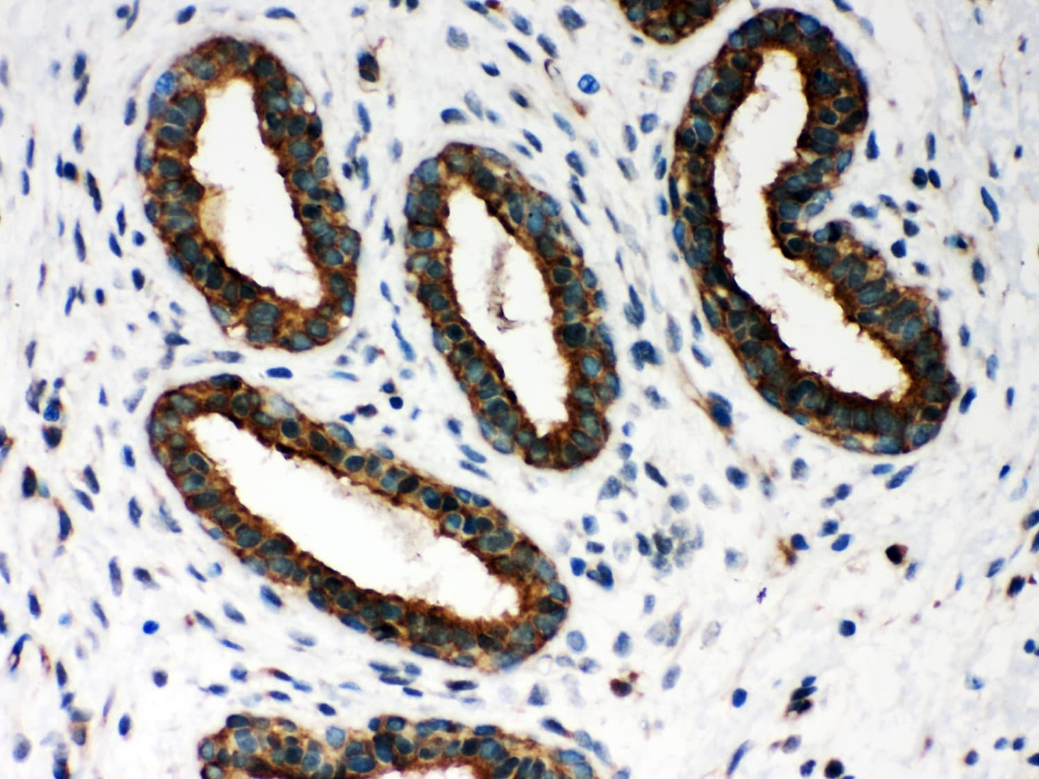 PRDX1 / Peroxiredoxin 1 Antibody (aa100-128)