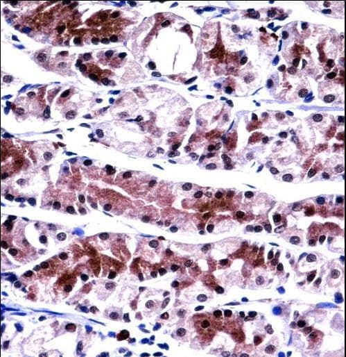 Polyclonal Rabbit anti-Human NXF1 / TAP Antibody (aa1-30, IHC, WB)