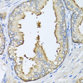 IHC-plus™ APG5 / ATG5 Antibody