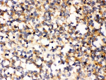 Polyclonal Rabbit anti-Human PAK7/PAK5 Antibody (IHC, WB)