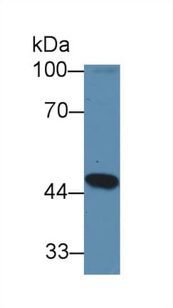 GCD / GCDH Antibody (APC)