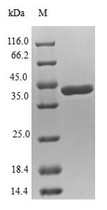 Human NUDT2 Protein (Recombinant GST, N-terminus)