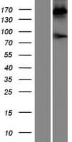PZP Protein (Over-Expression Lysate Myc-DDK (Flag))