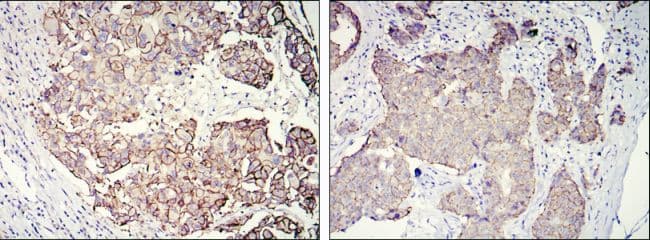 Monoclonal Mouse anti-Human ERBB2 / HER2 Antibody (clone 6C2, Amino Acid: 750-987, IHC, WB)