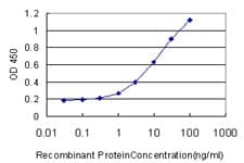 IHC-plus™ CBFA1 / RUNX2 Antibody (clone 3F5)