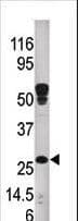 HSD17B10 / HADH2 Antibody (aa199-235)