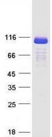 Human ESPN / Espin Protein (Recombinant Myc-DDK (Flag))