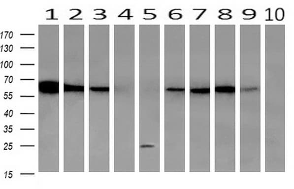 Monoclonal Mouse anti-Human GBP1 Antibody (clone OTI1B2, IHC, IF, WB)