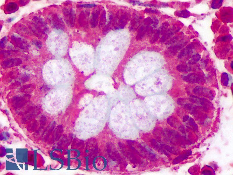 IHC-plus™ Polyclonal Rabbit anti-Human COL25A1 / Collagen XXV Antibody (aa430-443, IHC)