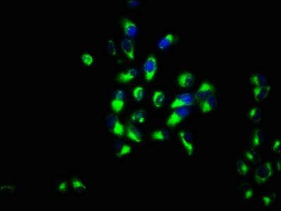 Polyclonal Rabbit anti-Human ABRI / ITM2B Antibody (IHC)