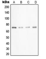 SAE2 / UBA2 Antibody (C-Terminus)