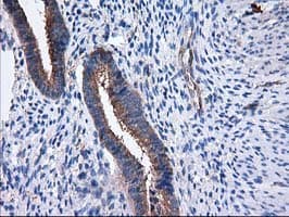 SULT1C2 / Sulfotransferase 1C2 Antibody (clone OTI4G1)