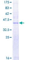 Human SLC50A1 / SCP Protein (Recombinant GST)